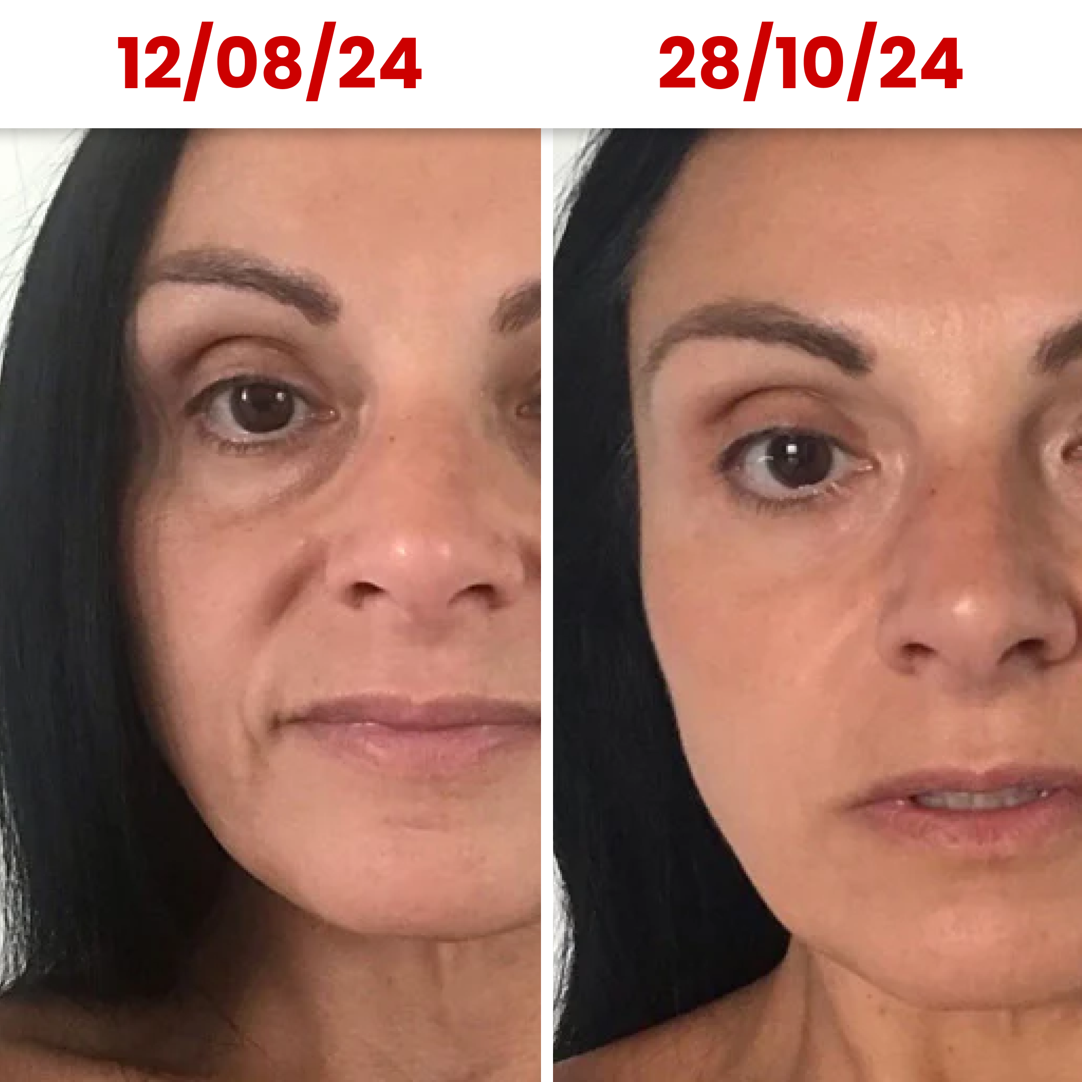 HydraGlow® Deep Face Mask