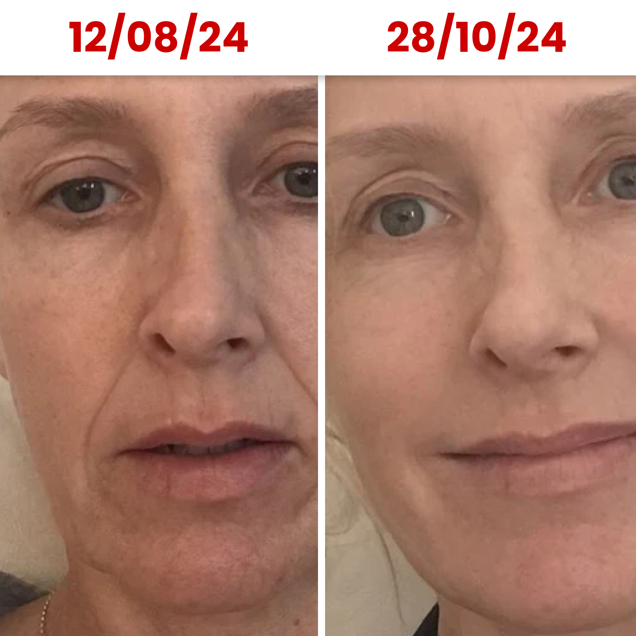 HydraGlow® Deep Face Mask