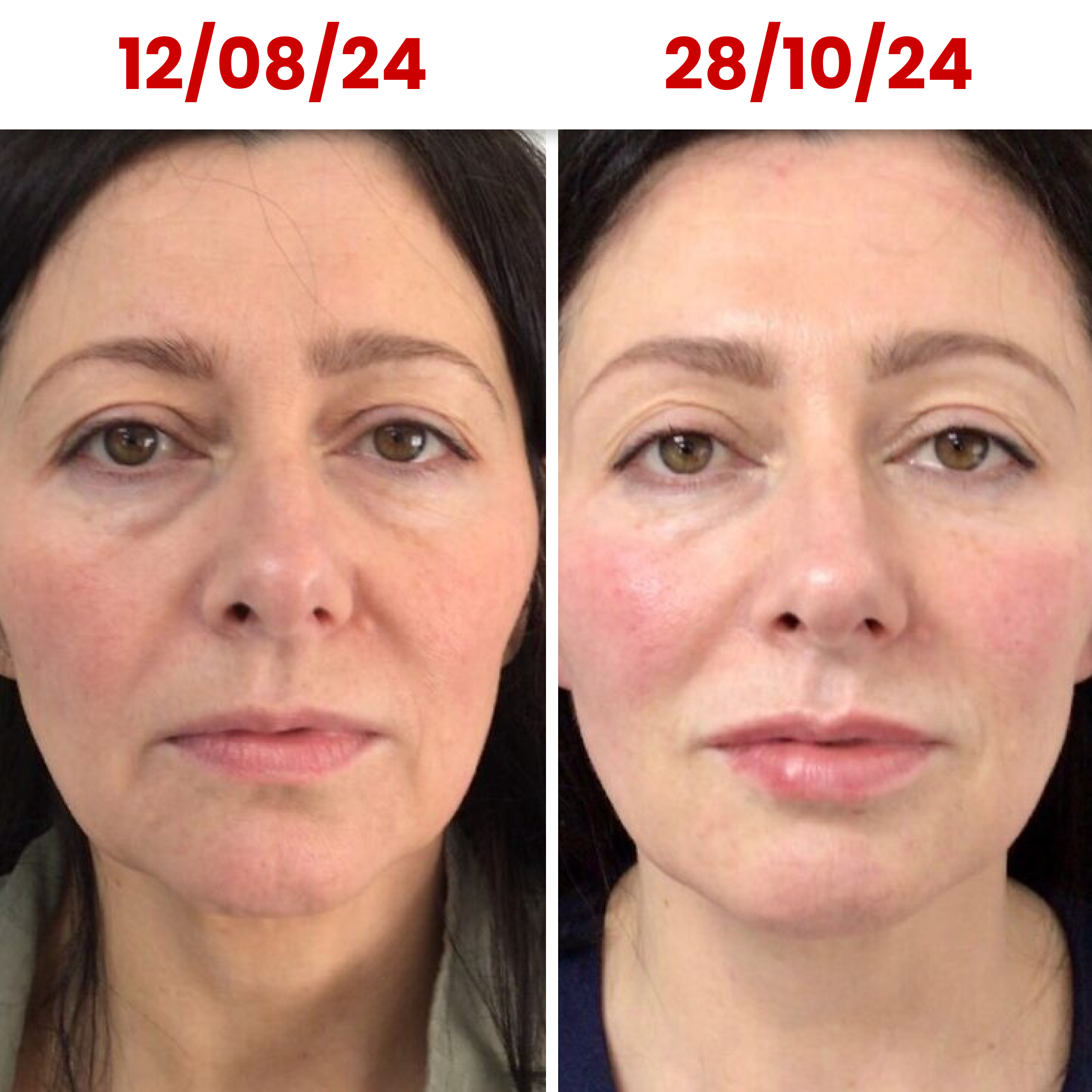 HydraGlow® Deep Face Mask