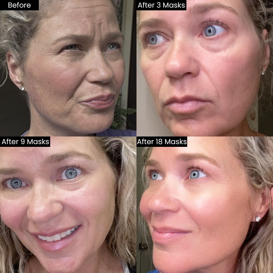 HydraGlow® Deep Face Mask